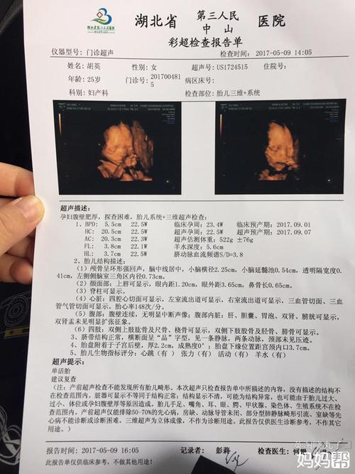 包生男孩双胞胎电话_包生男孩双胞胎电话的奇妙故事