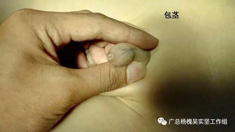 包生男孩过程-包生男孩：一个奇特的成长过程