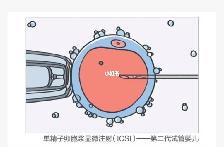 50万能找到试管代怀吗【50万能找到试管代怀吗?试管代怀需求不断增加】
